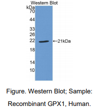 人谷胱甘肽过氧化酶1(GPX1)多克隆抗体