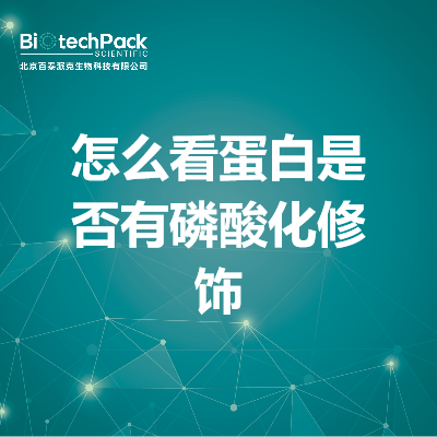 https://msimg.bioon.com/bionline/goods-no-pic.png