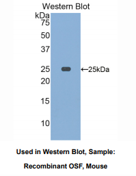 https://msimg.bioon.com/bionline/goods-no-pic.png