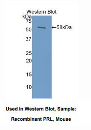 https://msimg.bioon.com/bionline/goods-no-pic.png