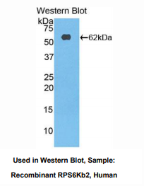 人核糖体蛋白S6激酶β2(RPS6Kb2)多克隆抗体