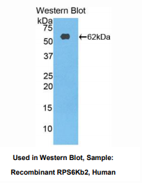 https://msimg.bioon.com/bionline/goods-no-pic.png