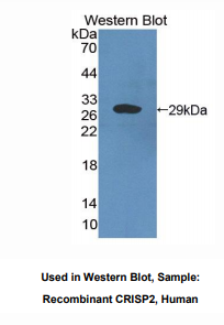 人半胱氨酸丰富分泌蛋白2(CRISP2)多克隆抗体