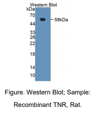 https://msimg.bioon.com/bionline/goods-no-pic.png