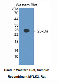 大鼠肌球蛋白轻链激酶2(MYLK2)多克隆抗体
