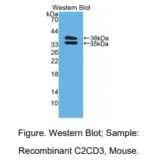 https://msimg.bioon.com/bionline/goods-no-pic.png