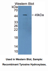 https://msimg.bioon.com/bionline/goods-no-pic.png