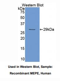 https://msimg.bioon.com/bionline/goods-no-pic.png