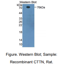 https://msimg.bioon.com/bionline/goods-no-pic.png