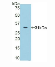 人尼克酰胺腺嘌呤二核苷酸磷酸氧化酶1(NOX1)多克隆抗体