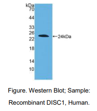 人精神分裂症破坏蛋白1(DISC1)多克隆抗体