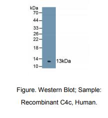 https://msimg.bioon.com/bionline/goods-no-pic.png