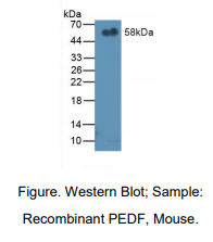 https://msimg.bioon.com/bionline/goods-no-pic.png