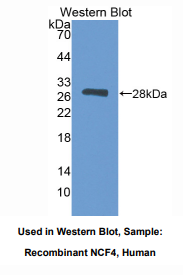 人嗜中性粒细胞胞浆因子4(NCF4)多克隆抗体