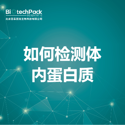 https://msimg.bioon.com/bionline/goods-no-pic.png