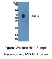 人膜联蛋白A6(ANXA6)多克隆抗体