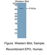人红细胞生成素(EPO)多克隆抗体
