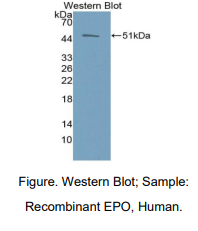 https://msimg.bioon.com/bionline/goods-no-pic.png