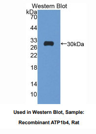 https://msimg.bioon.com/bionline/goods-no-pic.png