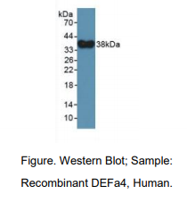 人防御素α4(DEFa4)多克隆抗体