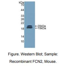 https://msimg.bioon.com/bionline/goods-no-pic.png