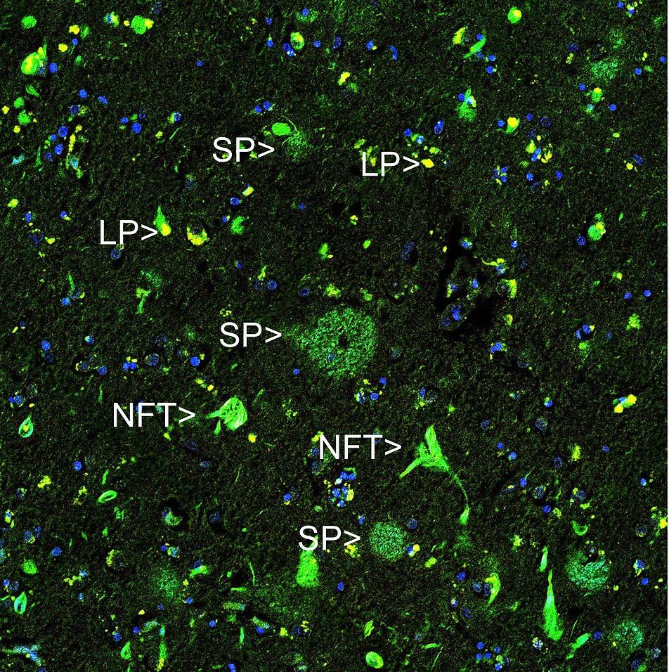 https://img.medsci.cn/e73eefcea40976357f460123cbf1e819c54e5106c9b457225be13b1cbc991aff.png