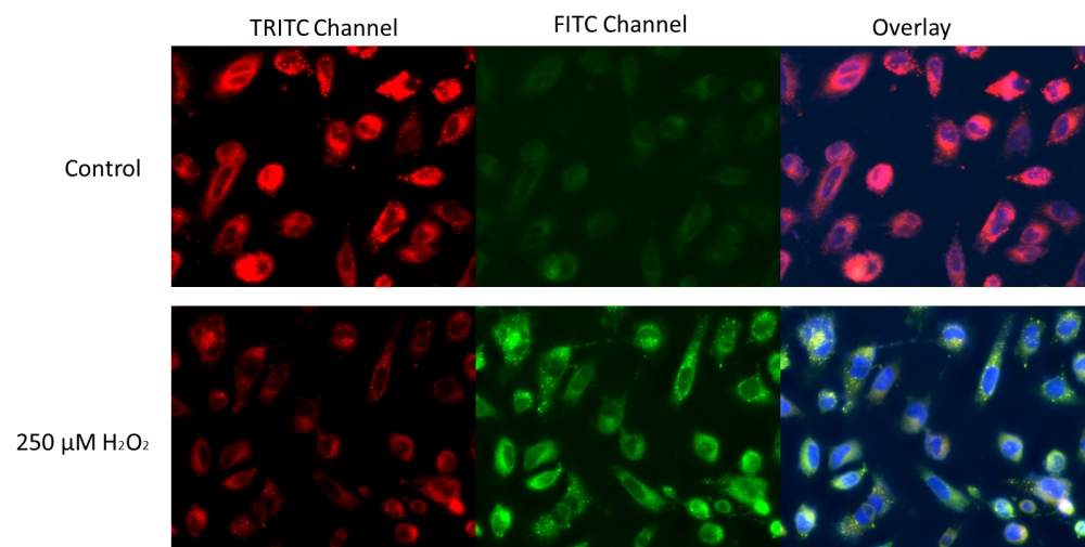 https://img.medsci.cn/e73eefcea40976357f460123cbf1e819c54e5106c9b457225be13b1cbc991aff.png