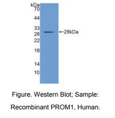 https://msimg.bioon.com/bionline/goods-no-pic.png