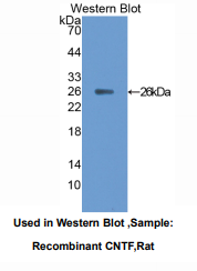 https://msimg.bioon.com/bionline/goods-no-pic.png