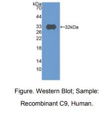 人补体成分9(C9)多克隆抗体