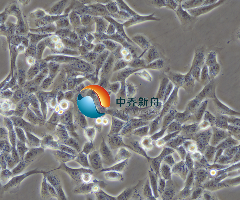 人骨肉瘤细胞