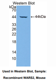 小鼠色氨酰tRNA合成酶2(WARS2)多克隆抗体