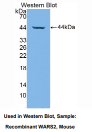 https://msimg.bioon.com/bionline/goods-no-pic.png