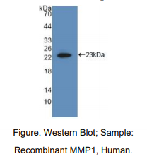 人基质金属蛋白酶1(MMP1)多克隆抗体