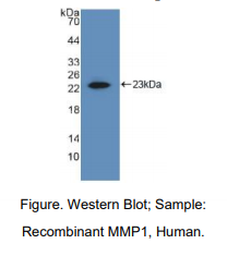 https://msimg.bioon.com/bionline/goods-no-pic.png