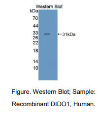 人死亡诱导终结因子1(DIDO1)多克隆抗体