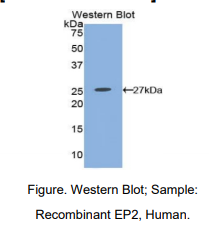 人前列腺素E受体2(EP2)多克隆抗体