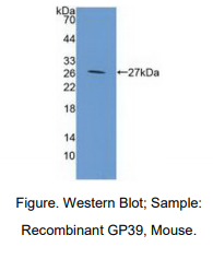 https://msimg.bioon.com/bionline/goods-no-pic.png