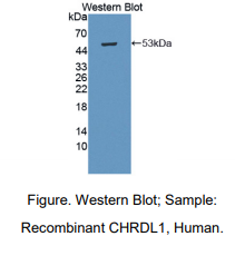 https://msimg.bioon.com/bionline/goods-no-pic.png