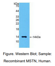 https://msimg.bioon.com/bionline/goods-no-pic.png