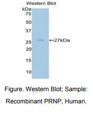 https://msimg.bioon.com/bionline/goods-no-pic.png