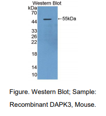 小鼠死亡关联蛋白激酶3(DAPK3)多克隆抗体