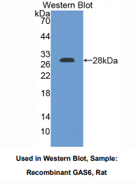 https://msimg.bioon.com/bionline/goods-no-pic.png