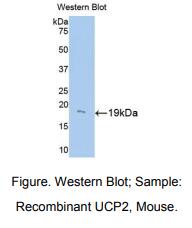 小鼠线粒体解偶联蛋白2(UCP2)多克隆抗体