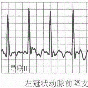 心梗动物模型