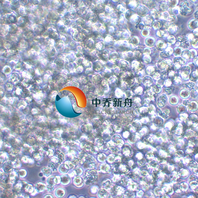 人胃癌细胞