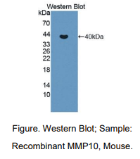 https://msimg.bioon.com/bionline/goods-no-pic.png