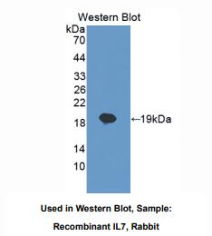 https://msimg.bioon.com/bionline/goods-no-pic.png