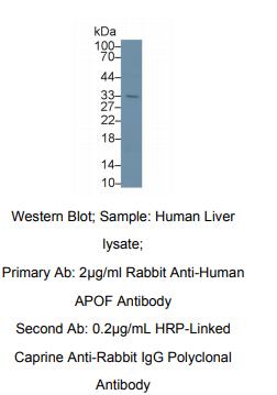 https://msimg.bioon.com/bionline/goods-no-pic.png