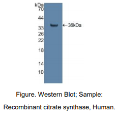 https://msimg.bioon.com/bionline/goods-no-pic.png